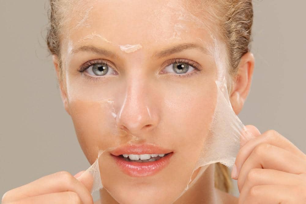 Chemical Peel in Richmond Hill
