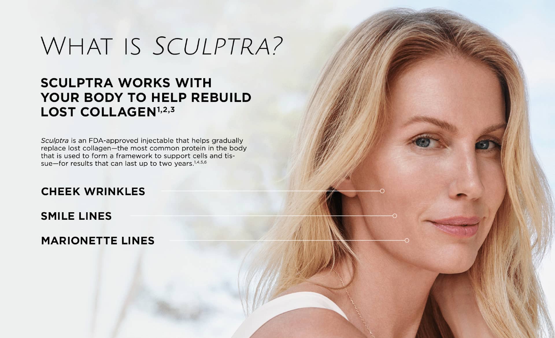 What is Sculptra in Richmond Hill
